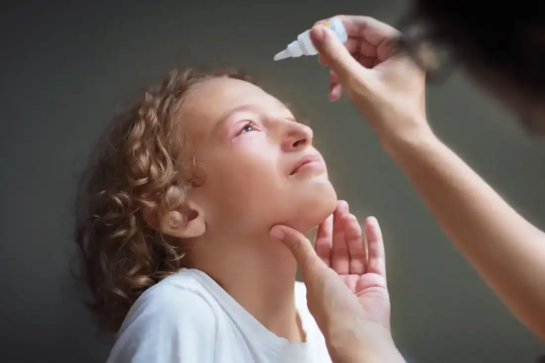 Caregiver applying eye drops for irritated eyes in Syracuse, Utah